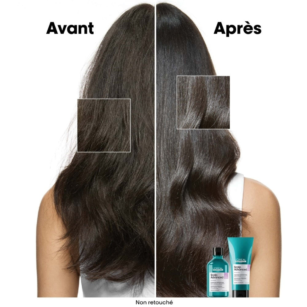 Scalp Advanced Anti-Discomfort Shampoo 