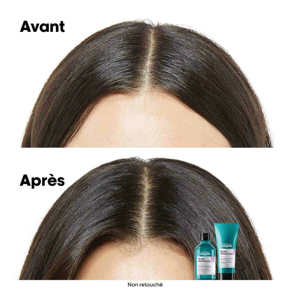 Scalp Advanced Anti-Discomfort Shampoo 