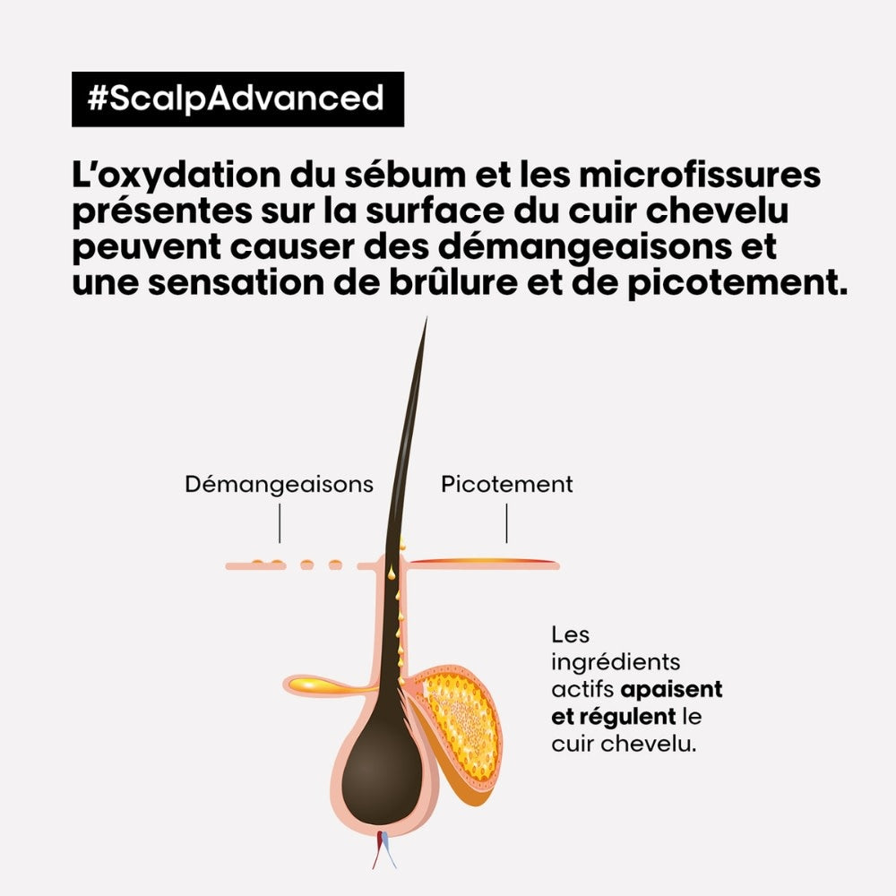 Traitement apaisant intense "Scalp Advanced" (200ml/6.7oz)