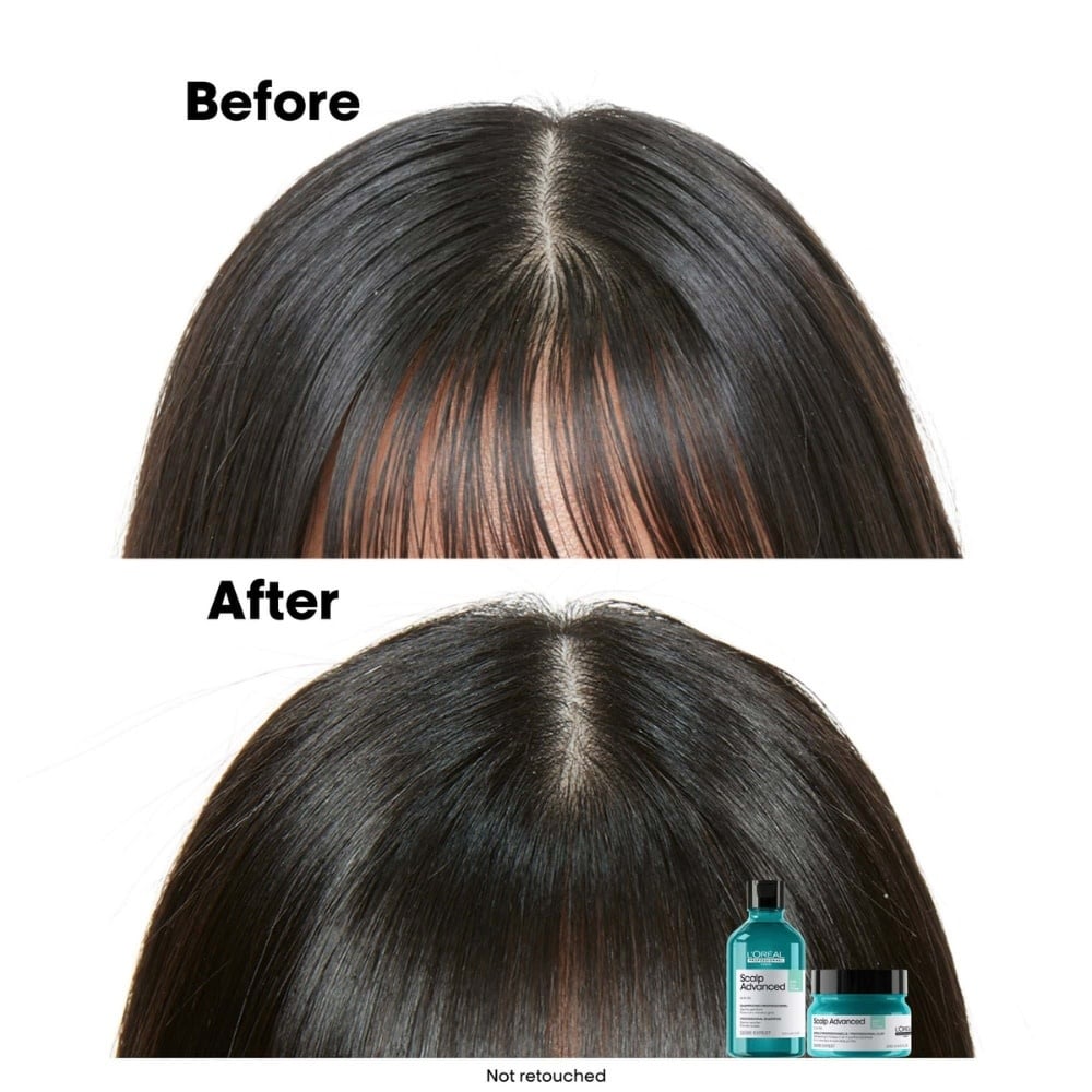 Shampoing dermo-purifiant anti-gras "Serie Expert Scalp Advanced Anti-Oilness" - Pour cuir chevelu gras