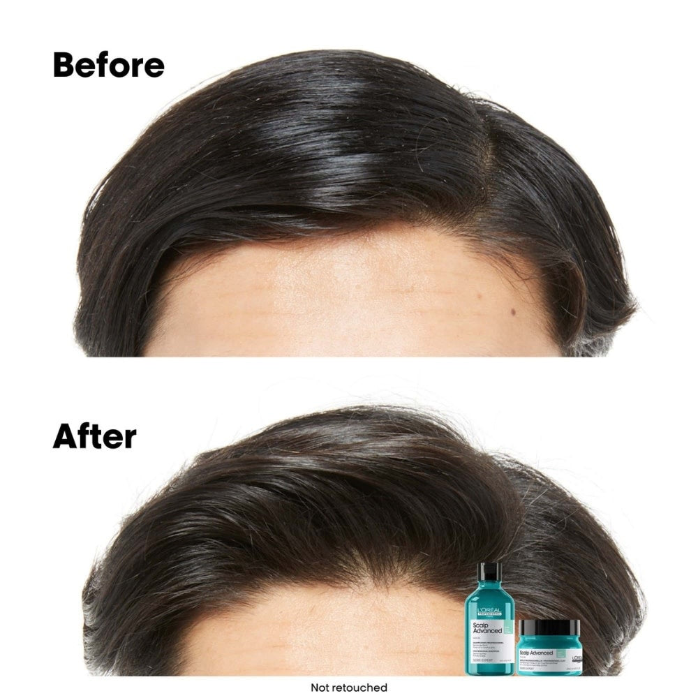 Shampoing dermo-purifiant anti-gras "Serie Expert Scalp Advanced Anti-Oilness" - Pour cuir chevelu gras
