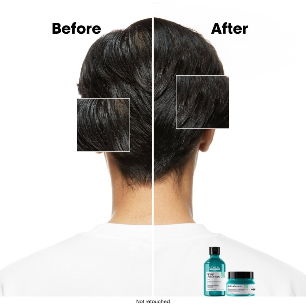 Shampoing dermo-purifiant anti-gras "Serie Expert Scalp Advanced Anti-Oilness" - Pour cuir chevelu gras