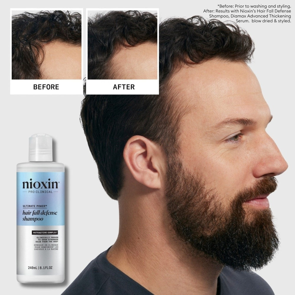 Ultimate Power Hair Fall Defense Shampoo