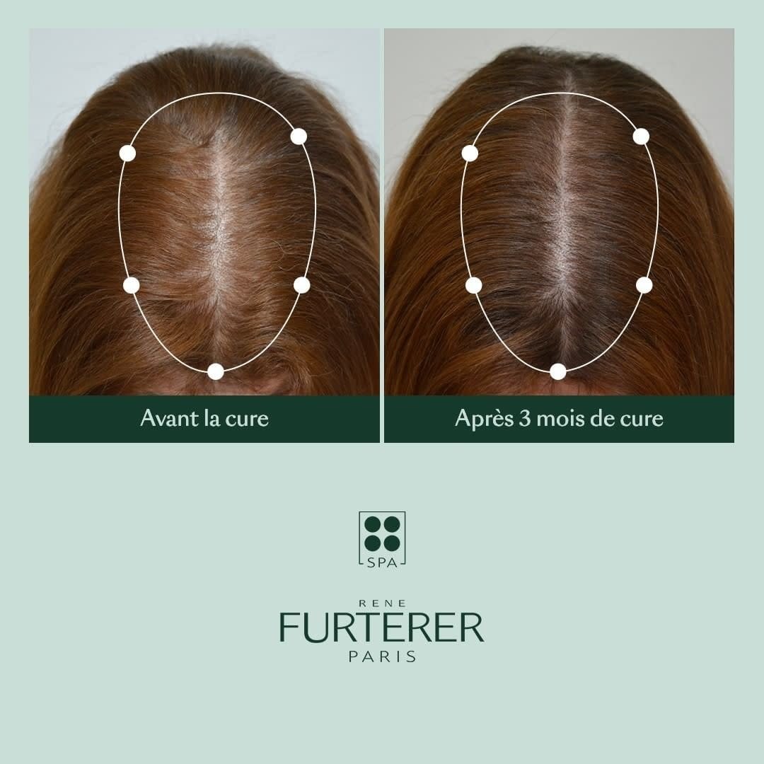 Shampoing épaississant "Triphasic" freine la perte de densité - Favorise la croissance des cheveux
