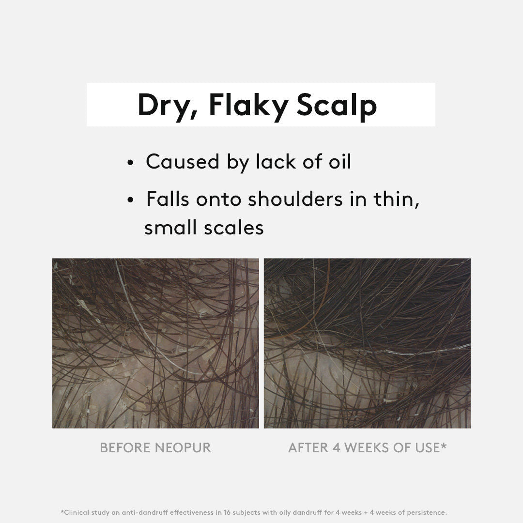 Neopur Anti-Dandruff Shampoo 