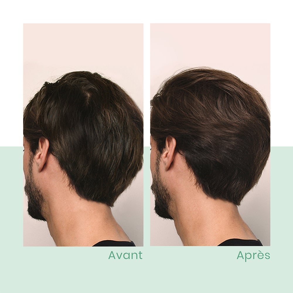 Shampoing épaississant "Triphasic" freine la perte de densité - Favorise la croissance des cheveux