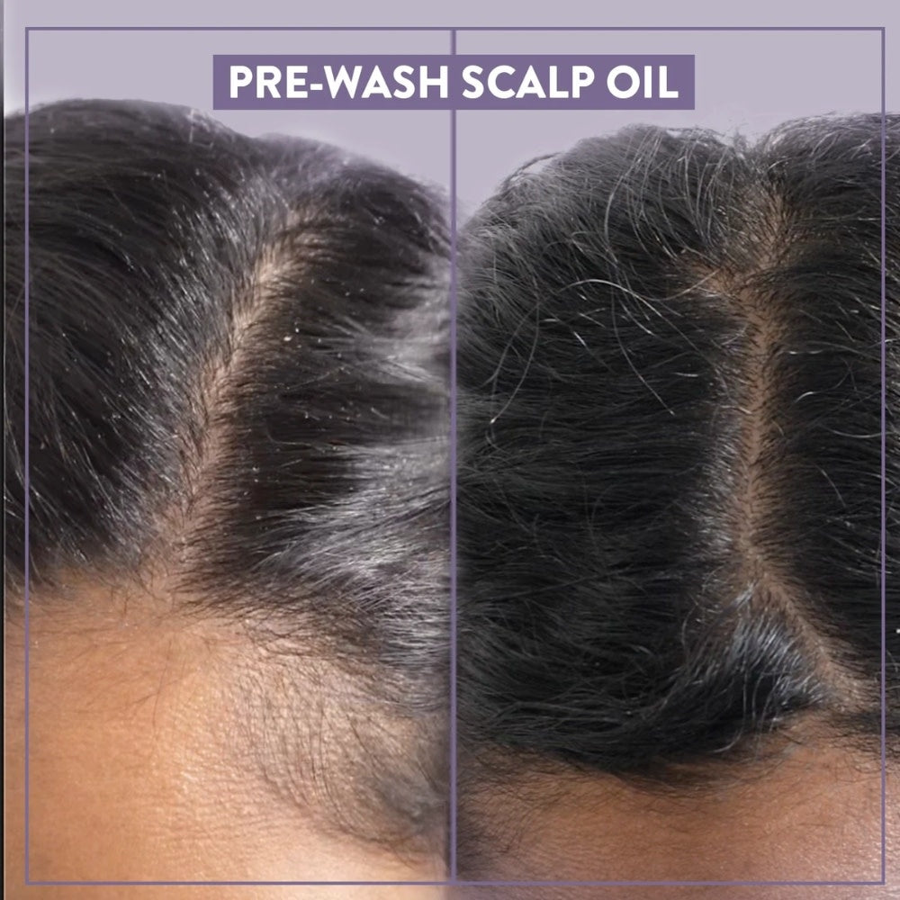 Huile cuir chevelu "Pre-Wash Scalp Oil" (35ml/1.2oz)