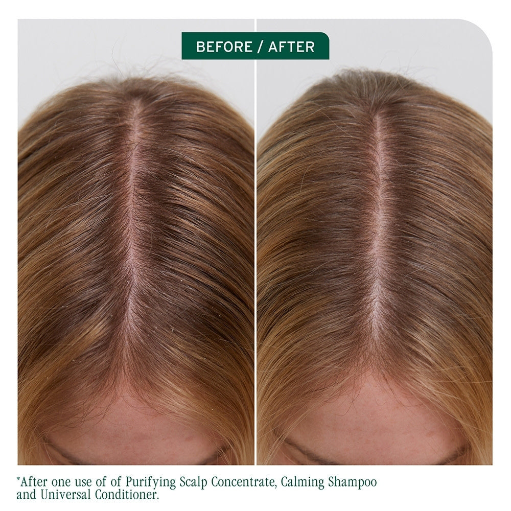 Scalp Sync Purifying Scalp Concentrate (200ml/6.8oz)