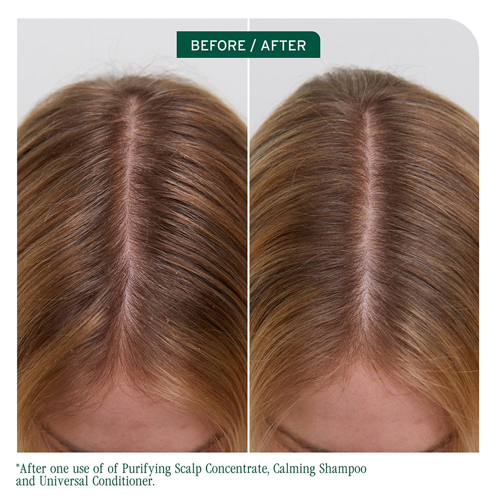 Revitalisant universel "Scalp Sync"