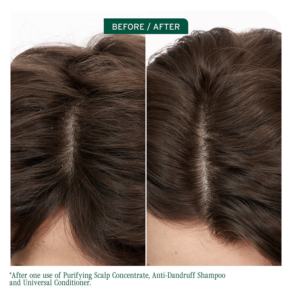 Revitalisant universel "Scalp Sync"