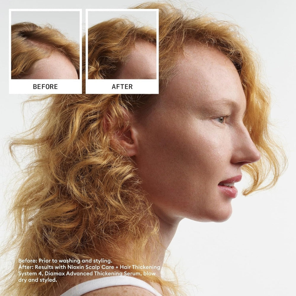 Trio shampoing, revitalisant et traitement sans rinçage cheveux + cuir chevelu Système 4 - Pour cheveux colorés avec chute avancée (2x 300ml/10.1oz, 100ml/3.38oz)