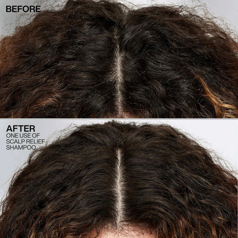 Shampoing antipelliculaire "Scalp Relief" riche en pyrithione de zinc - Pour cheveux et cuir chevelu sec et avec pellicules (250ml/8.5oz)